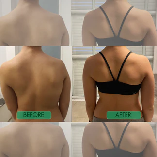 PostureBoost™ - Posture Corrector