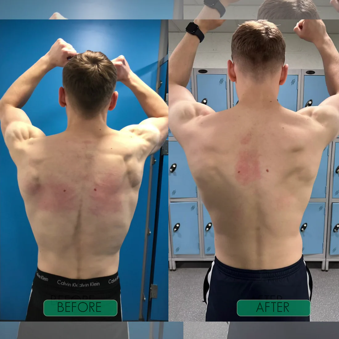 PostureBoost™ - Posture Corrector