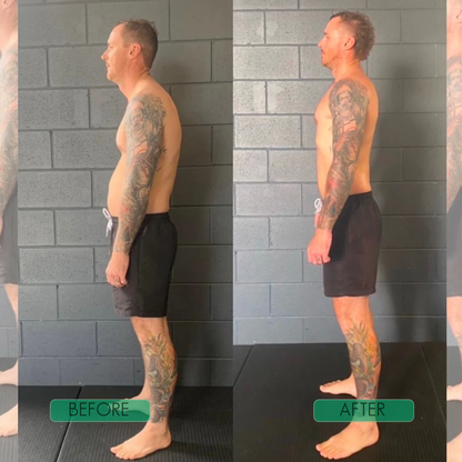 PostureBoost™ - Posture Corrector